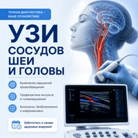 Скидка 10% на ультразвуковое исследование сосудов шеи и головы